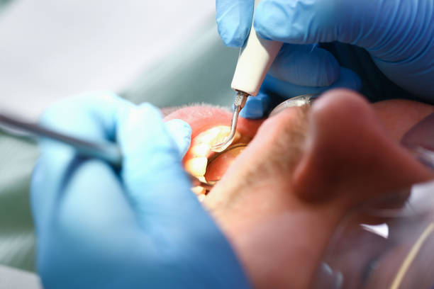 Best Emergency Dental Services for Seniors in Durant, OK